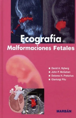 ECOGRAFIA MALFORMACIONES FETALES TAPA BLANDA