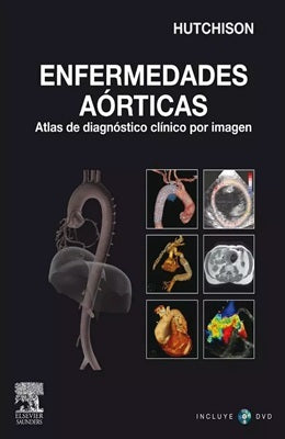 ENFERMEDADES AORTICAS ATLAS DE DIAGNOSTICO CLINICO POR IMAGEN DVD