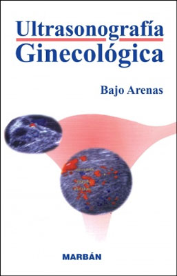 ULTRASONOGRAFIA GINECOLOGICA
