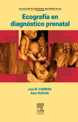 ECOGRAFIA EN DIAGNOSTICO PRENATAL