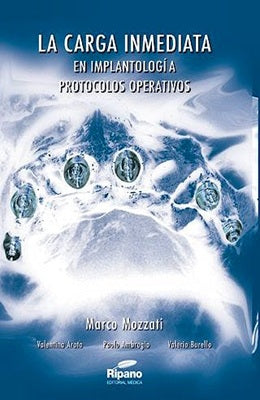 LA CARGA INMEDIATA EN IMPLANTOLOGIA PROTOCOLOS OPERATIVOS