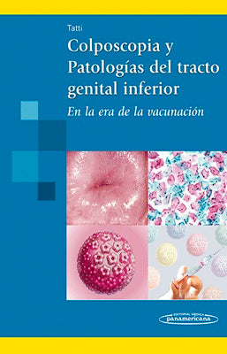 COLPOSCOPIA Y PATOLOGIAS DEL TRACTO GENITAL INFERIOR EN LA ERA DE LA VACUNACION