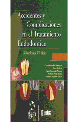 ACCIDENTES Y COMPLICACIONES EN EL TRATAMIENTO ENDODONTICO