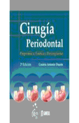 CIRUGIA PERIODONTAL