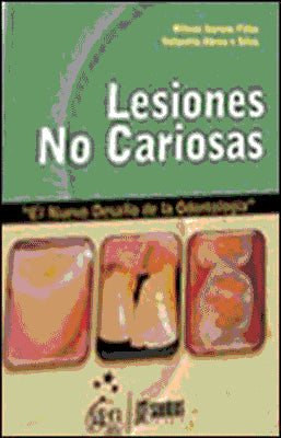 LESIONES NO CARIOSAS