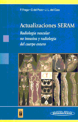 ACTUALIZACIONES SERAM  RADIOLOGIA VASCULAR NO INVASIVA Y RADIOLOGIA DEL CUERPO ENTERO