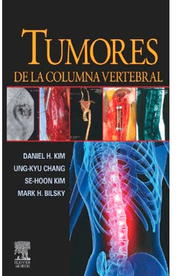 TUMORES DE LA COLUMNA VERTEBRAL +CD