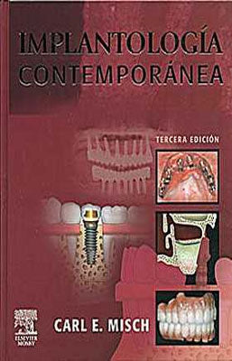 IMPLANTOLOGIA CONTEMPORANEA
