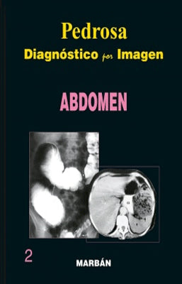 DIAGNOSTICO POR IMAGEN ABDOMEN 2
