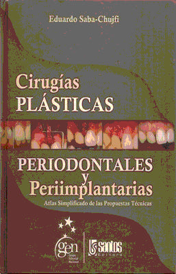 CIRUGIA PLASTICAS PERIODONTALES Y PERIIMPLANTARIAS