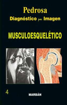 DIAGNOSTICO POR  IMAGEN MUSCULOESQUELETICO DE PEDROSA