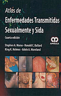ATLAS DE ENFERMEDADES TRANSMITIDAS SEXUALMENTE Y SIDA