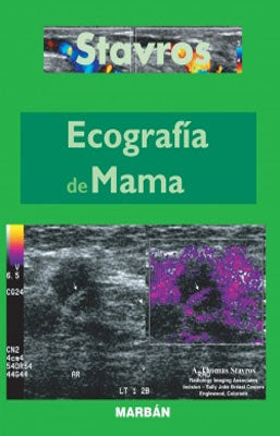 ECOGRAFIA DE MAMA