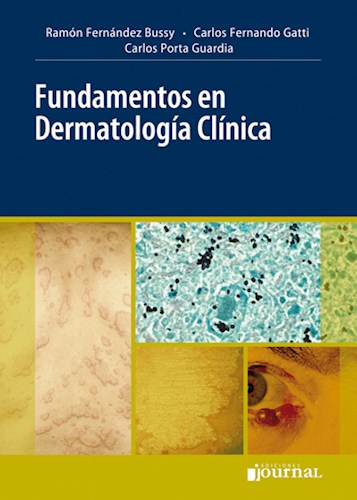FUNDAMENTOS EN DERMATOLOGIA CLINICA