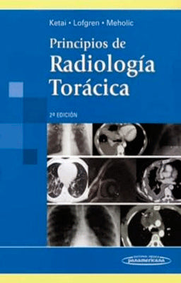 PRINCIPIOS DE RADIOLOGIA TORACICA