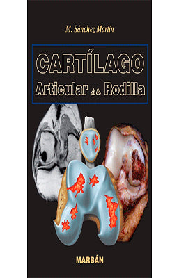 CARTILAGO ARTICULAR DE LA RODILLA