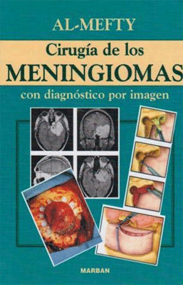CIRUGIA DE LOS MENINGIOMAS