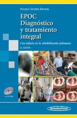 DIAGNOSTICO Y MANEJO INTEGRAL DEL PACIENTE CON EPOC