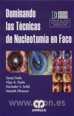 DOMINANDO LAS TECNICAS DE NUCLEOTOMIA EN FACO