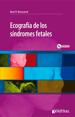 ECOGRAFIA DE LOS SINDROMES FETALES + CD