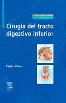 CIRUGIA DEL TRACTO DIGESTIVO INFERIOR