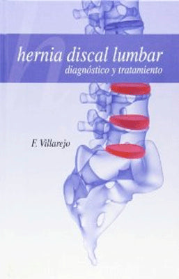 HERNIA DISCAL LUMBAR DIAGNOSTICO Y TRATAMIENTO