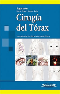 CIRUGIA DEL TORAX