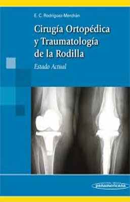 CIRUGIA ORTOPEDICA Y TRAUMATOLOGIA DE LA RODILLA