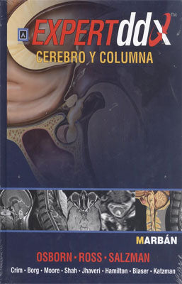 EXPERT DDX CEREBRO Y COLUMNA