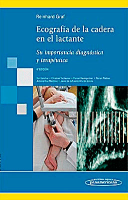 ECOGRAFIA DE LA CADERA EN EL LACTANTE