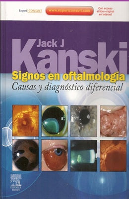 SIGNOS EN OFTALMOLOGIA CAUSAS Y DIAGNOSTICO DIFERENCIAL