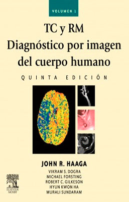 TC Y RM DIAGNOSTICO POR IMAGEN DEL CUERPO HUMANO 5TA EDICION