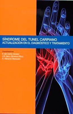 SINDROME DEL TUNEL CARPIANO