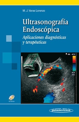 ULTRASONOGRAFIA ENDOSCOPICA APLICACIONES DIAGNOSTICAS Y TERAPEUTICAS + CD