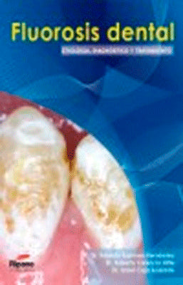 FLUOROSIS DENTAL