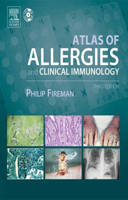 ATLAS DE ALERGIA E INMUNOLOGIA CLINICA + CD