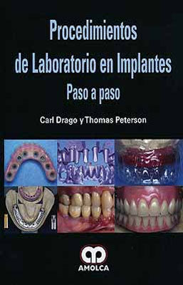 PROCEDIMIENTOS DE LABORATORIO EN IMPLANTES PASO A PASO