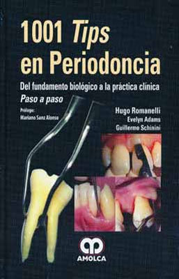 1001 TIPS EN PERIODONCIA