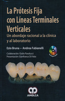 LA PROTESIS FIJA CON LINEAS TERMINALES VERTICALES + DVD