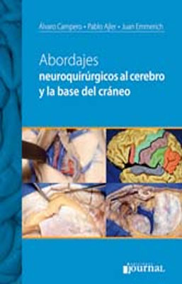 ABORDAJES NEUROQUIRURGICOS AL CEREBRO Y LA BASE DEL CRANEO