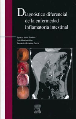 DIAGNOSTICO DIFERENCIAL DE LA ENFERMEDAD INFLAMATORIA INTESTINAL