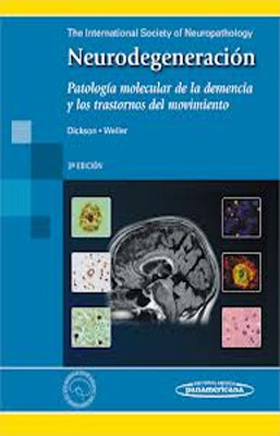 NEURODEGENERACION