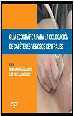 GUIA ECOGRAFICA PARA LA COLOCACION DE CATETERES VENOSOS CENTRALES