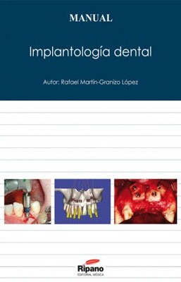 IMPLANTOLOGIA DENTAL