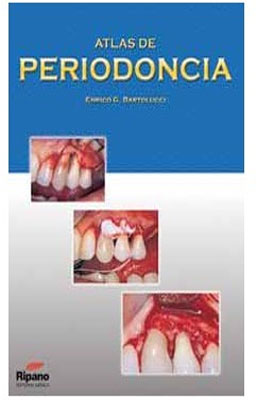 ATLAS DE PERIODONCIA