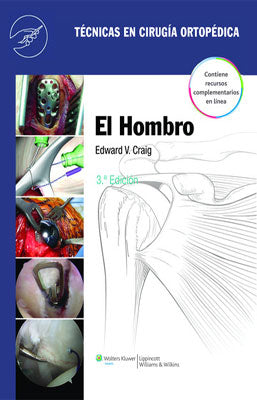TECNICAS EN CIRUGIA ORTOPEDICA EL HOMBRO