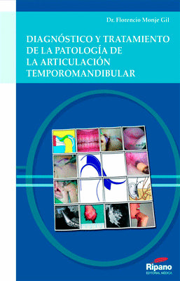DIAGNOSTICO Y TRATAMIENTO DE LA PATOLOGIA DE LA ARTICULACION TEMPOROMANDIBULAR