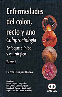 ENFERMEDADES DEL COLON RECTO Y ANO COLOPROCTOLOGIA ENFOQUE CLINICO Y QUIRURGICO