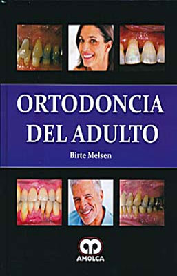 ORTODONCIA DEL ADULTO