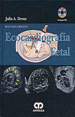 ECOCARDIOGRAFIA FETAL + CD